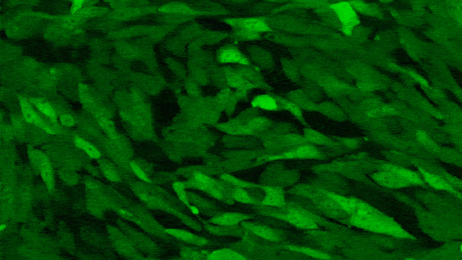 Animated microscopic image of the glioblastoma's tumor microenvironment