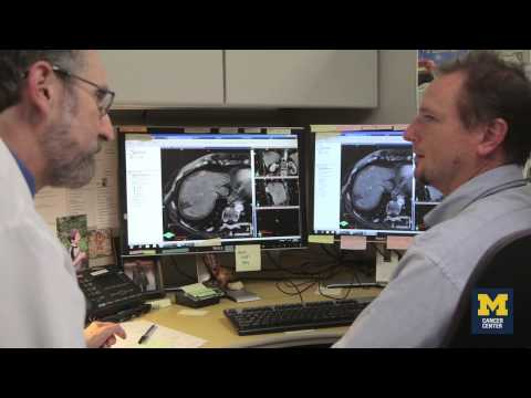 Personalized Radiation Therapy | Michigan Health Lab