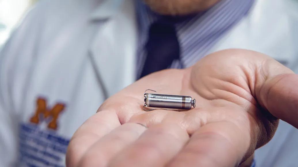 The smallest pacemaker fits in the palm of a hand