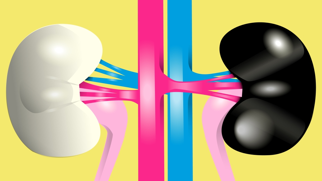 kidney black white and pink and blue lines