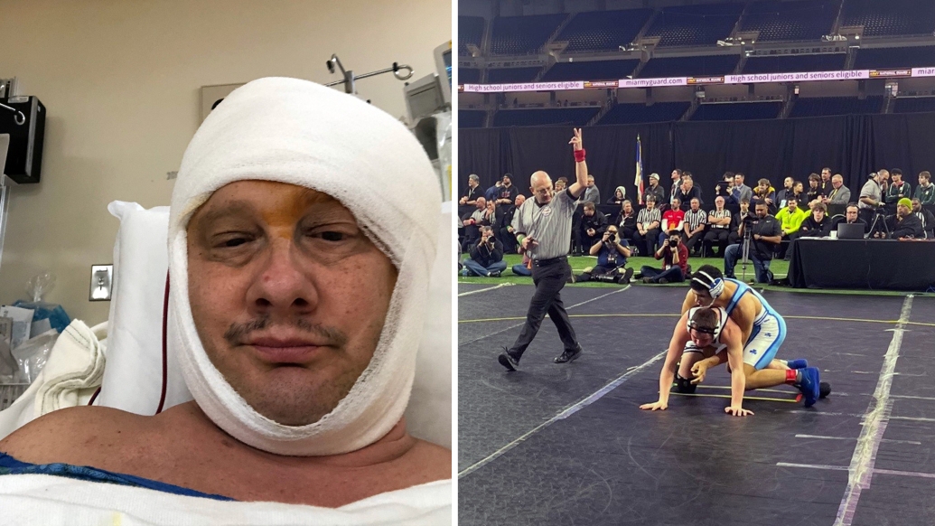 bandage on head and wrestling match ref