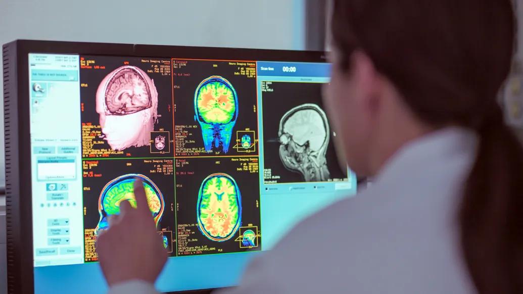 images on computer of scans