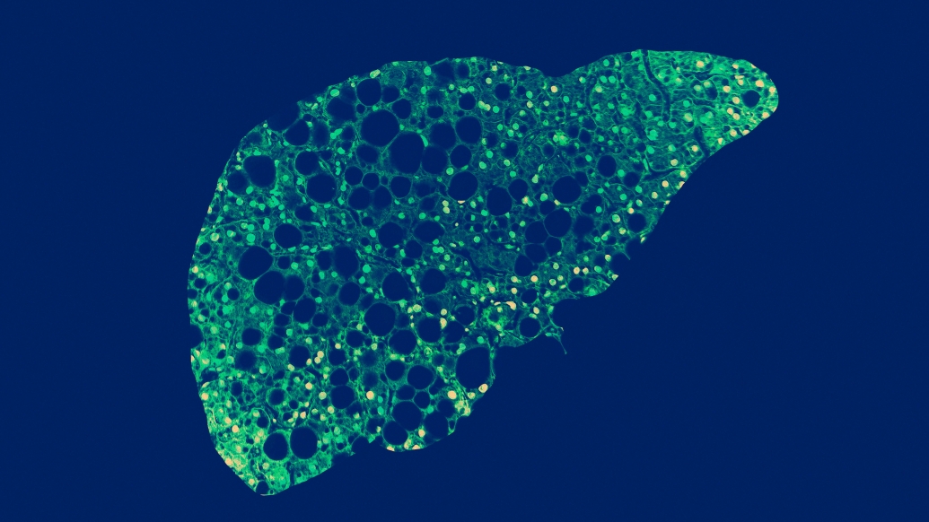 liver in bright green against navy background