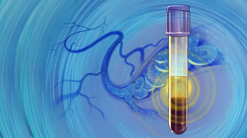 vial of blood with blue background cell floating