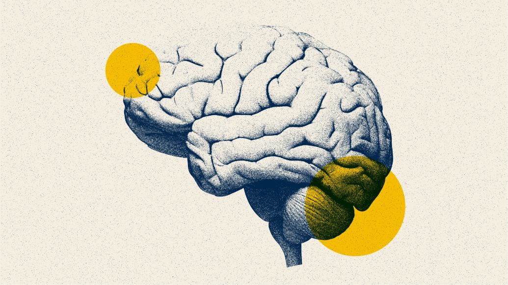 Brain image highlighting areas