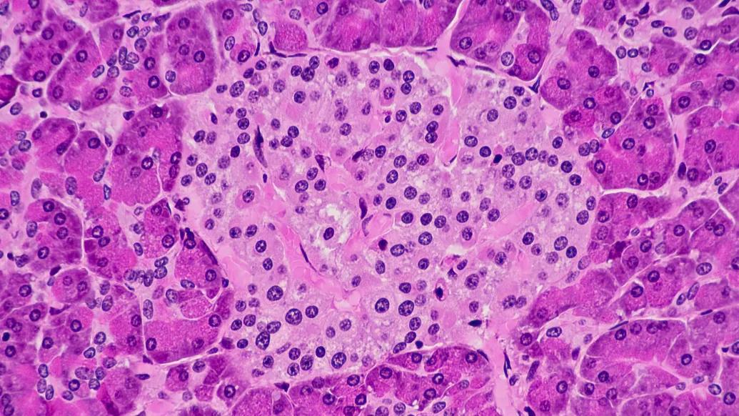 purple cells floating up close