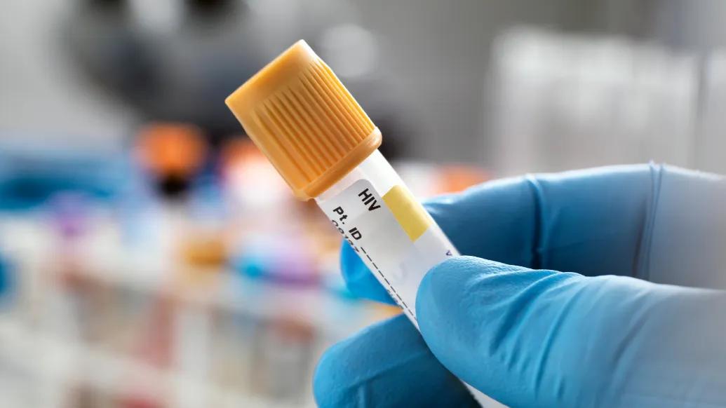 Medical gloved hand holding test tube sample for HIV testing.