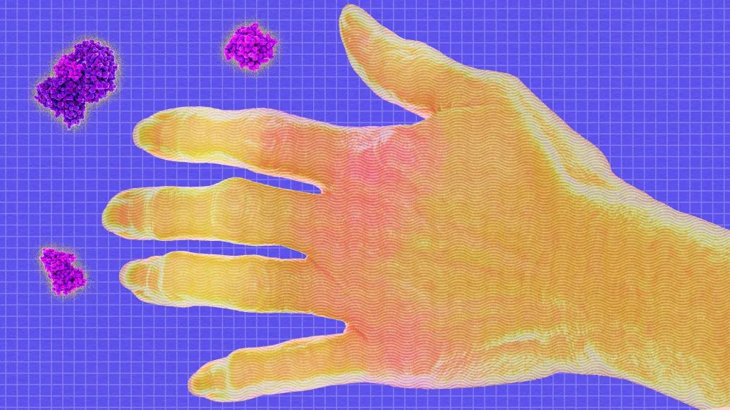 Illustration of hand and enzymes that affect scleroderma patients