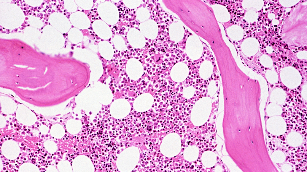 Microscopic image of bone marrow with pink and white hues