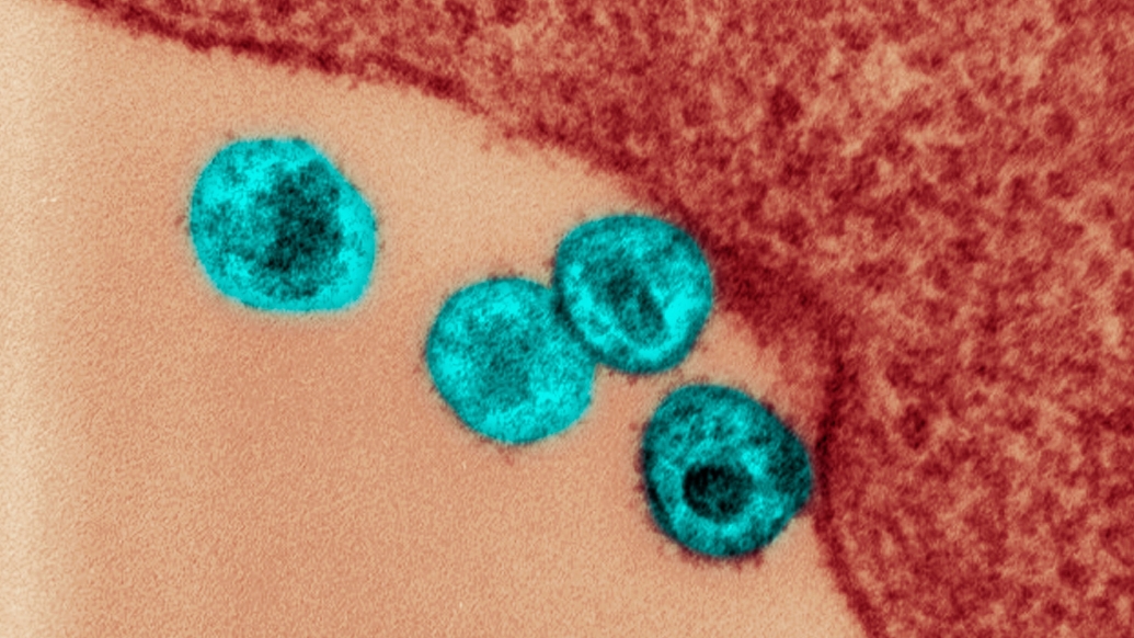 Enlargement of microscopic HIV virus cells 