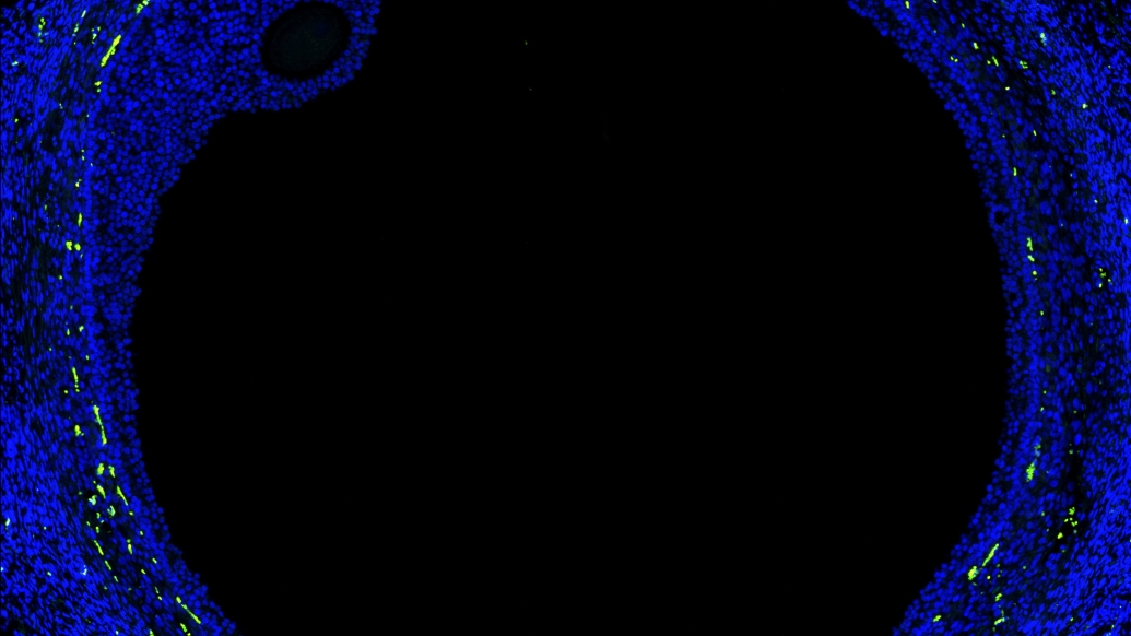 Florescent image of a human ovarian follicle