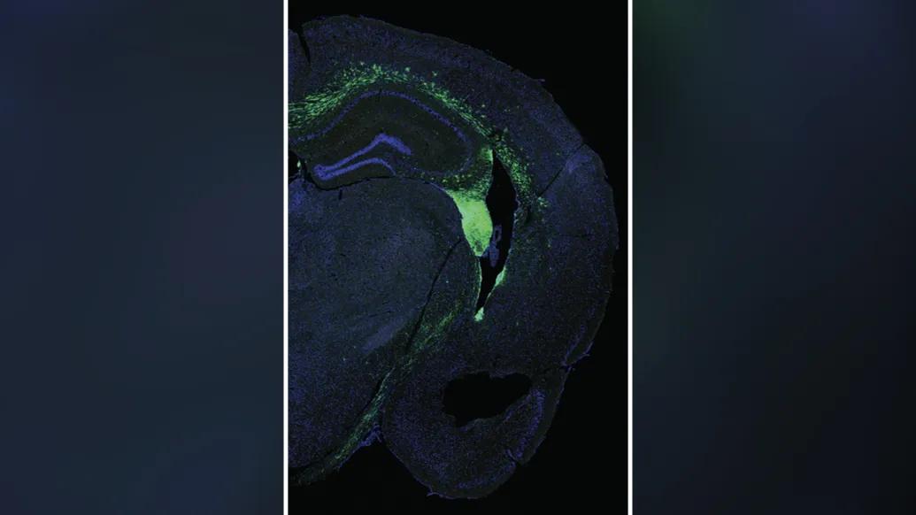 Xray of a stem cell in a mouse brain.