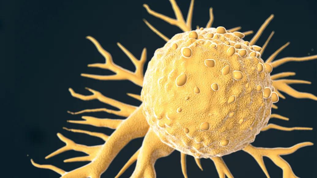 Cancer cell microscopic, colored yellow