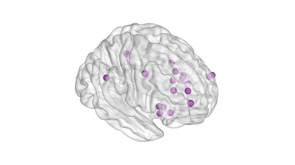 grey brain with purple dots