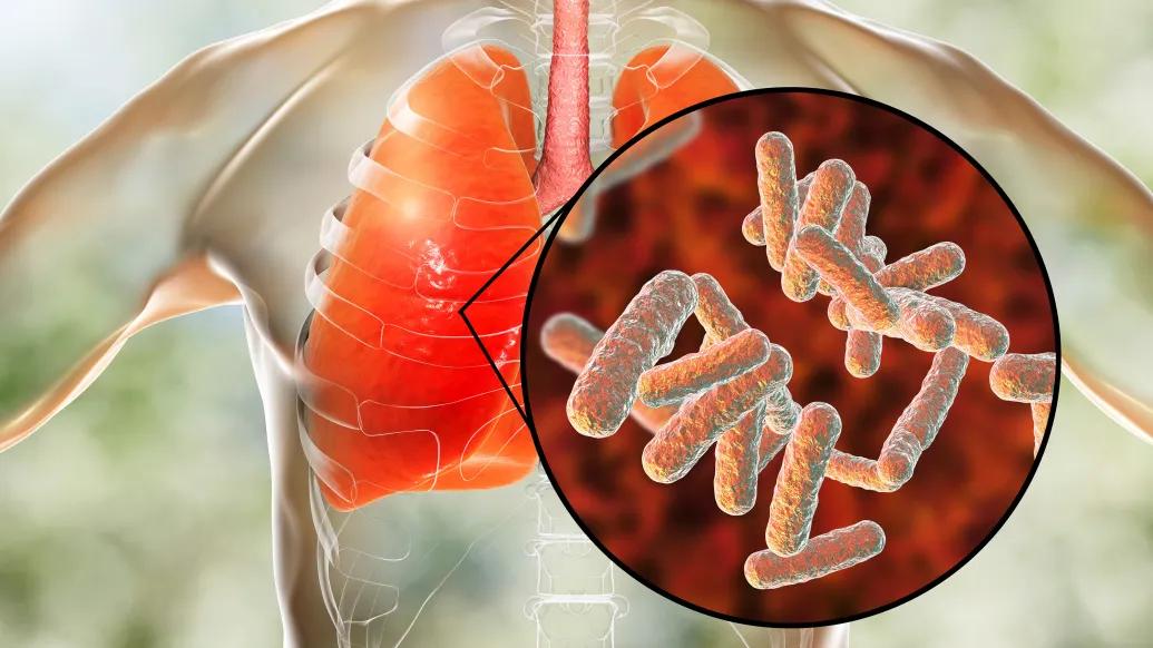 cells up close from inside lungs in red in the image of a clear see through body