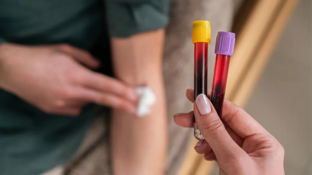 blood test bottles above arm with white bandaid