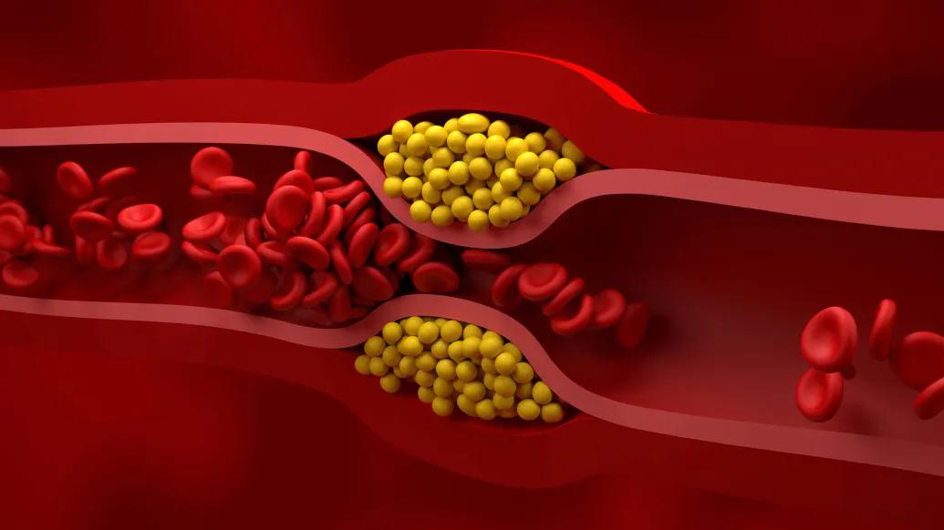 blood vessel up close with red cells and yellow inside