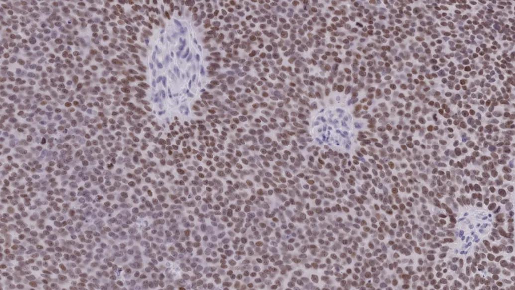 cells purple some lighter cells in white