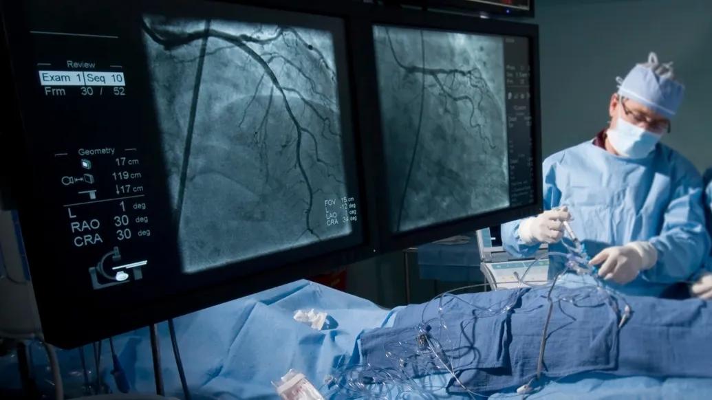 up close doctor in hospital with cardiology close up scans on monitors
