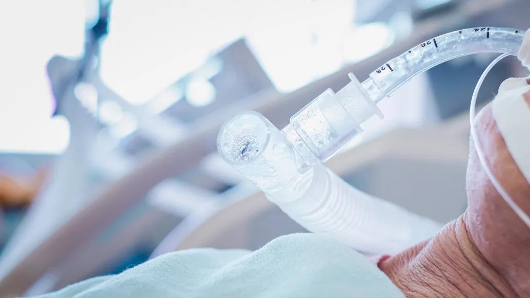 breathing tube in patient close up in hospital bed