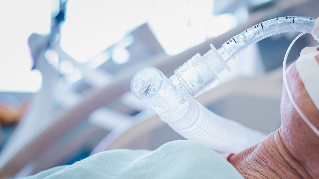 breathing tube in patient close up in hospital bed