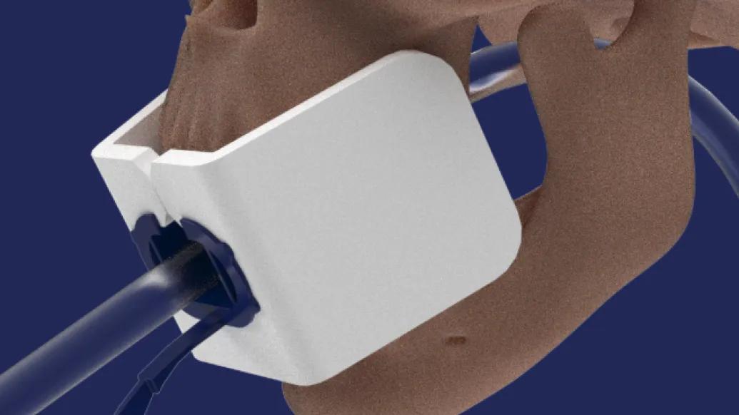 image of a white shape over a mouth of a skull model that's tan on a blue background