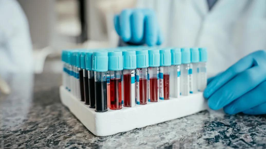 blood vials together with blue caps and blue gloves 