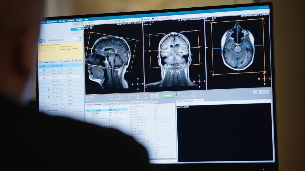 brain scan on computer