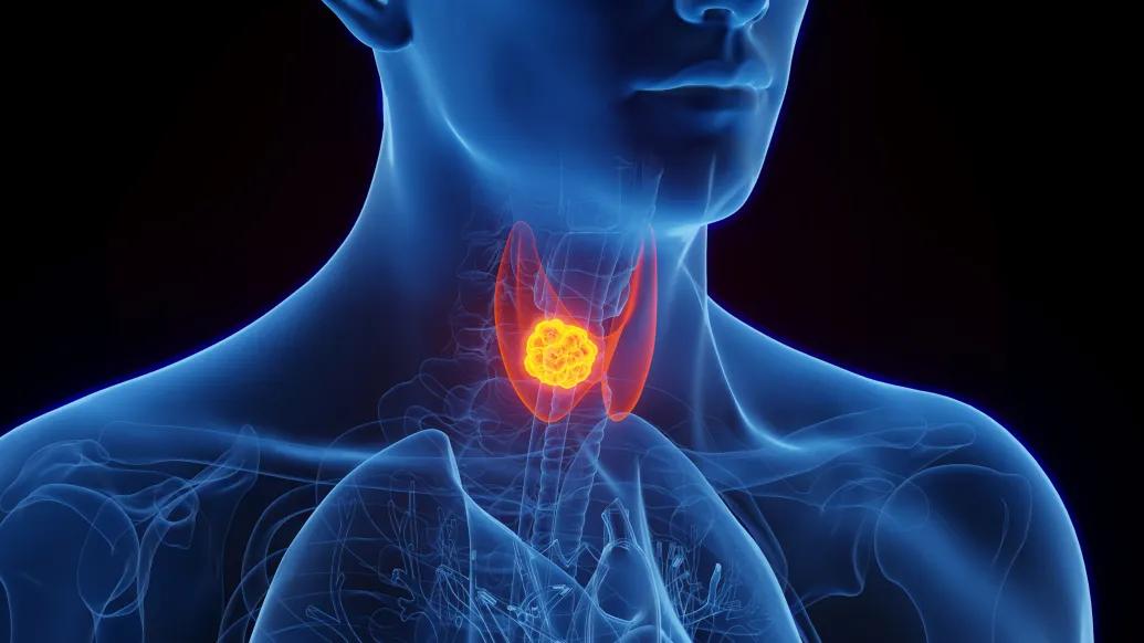 graphic of inside of a person's throat lit up orange and red 