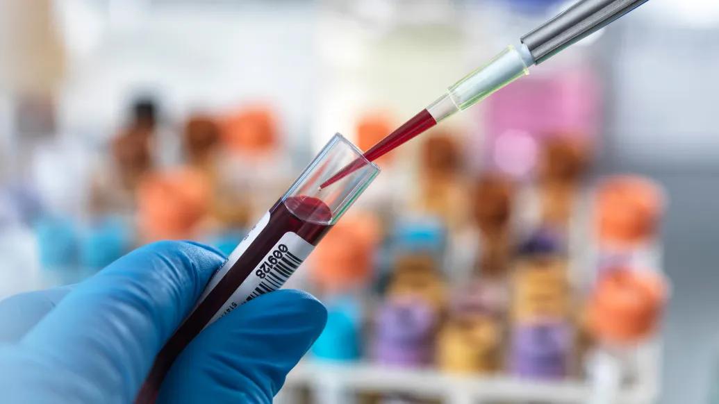 blood vial blue gloves blurred background