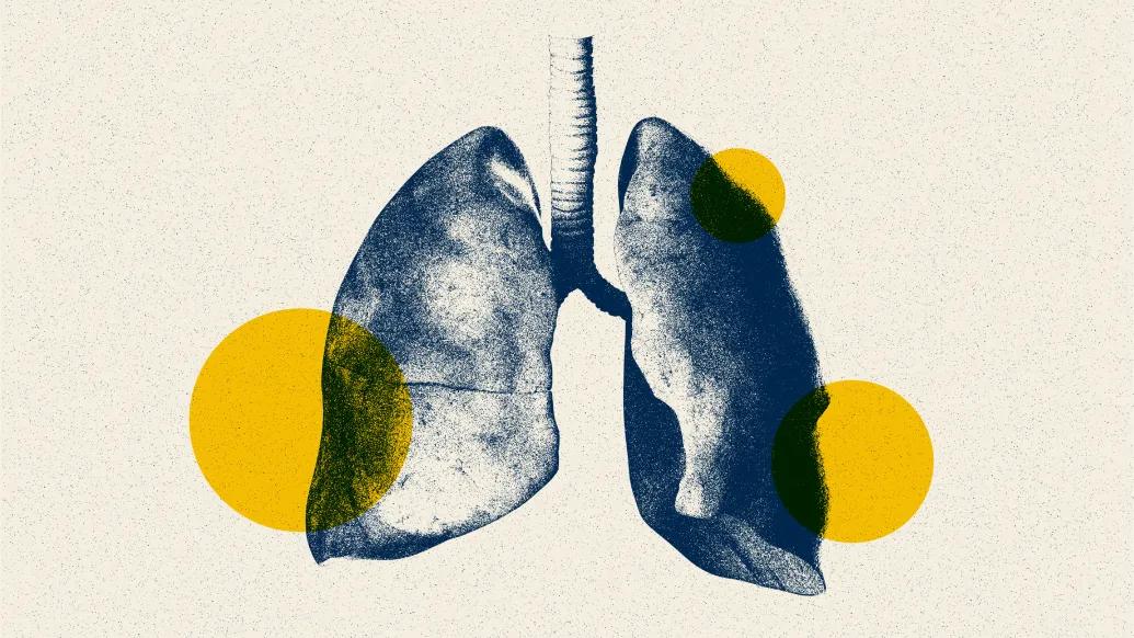 lungs in blue and yellow spots floating