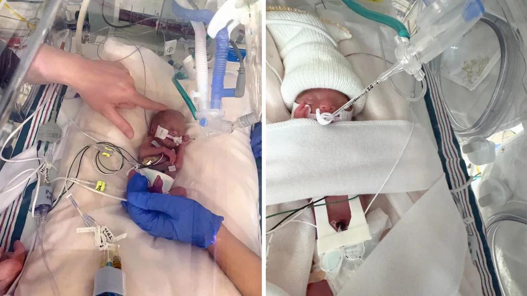 newborn babies left and right in neonatal intensive care unit