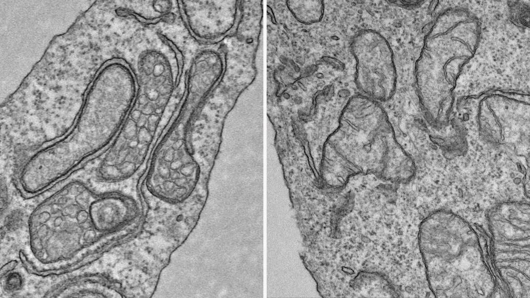close up microscopic grey close up