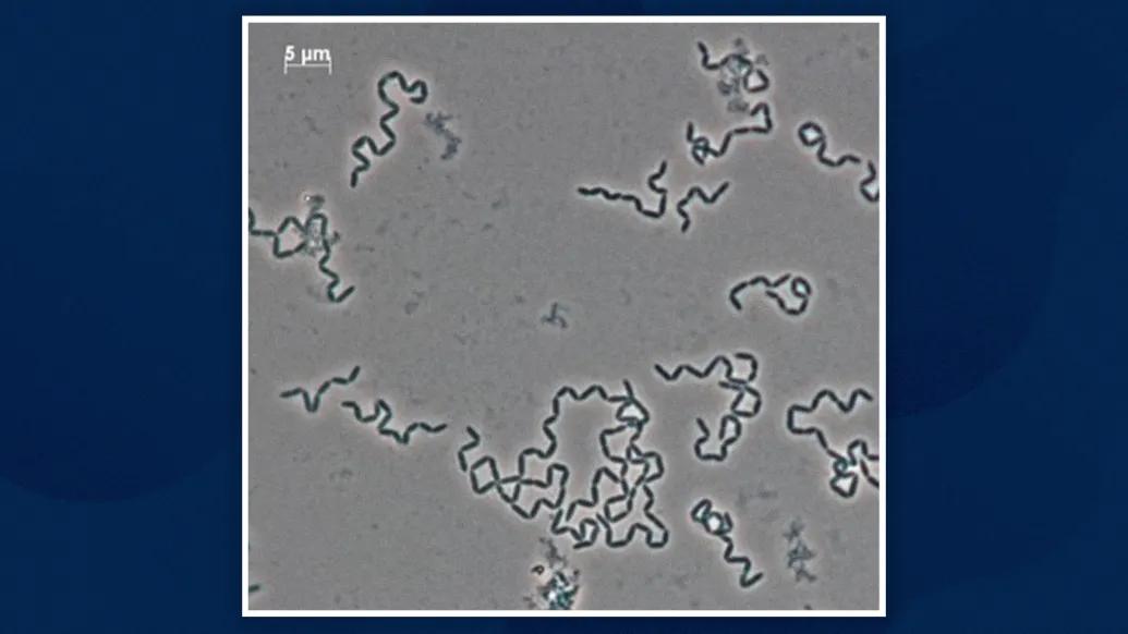 close up of cells moving in blue lines grey background under microscope