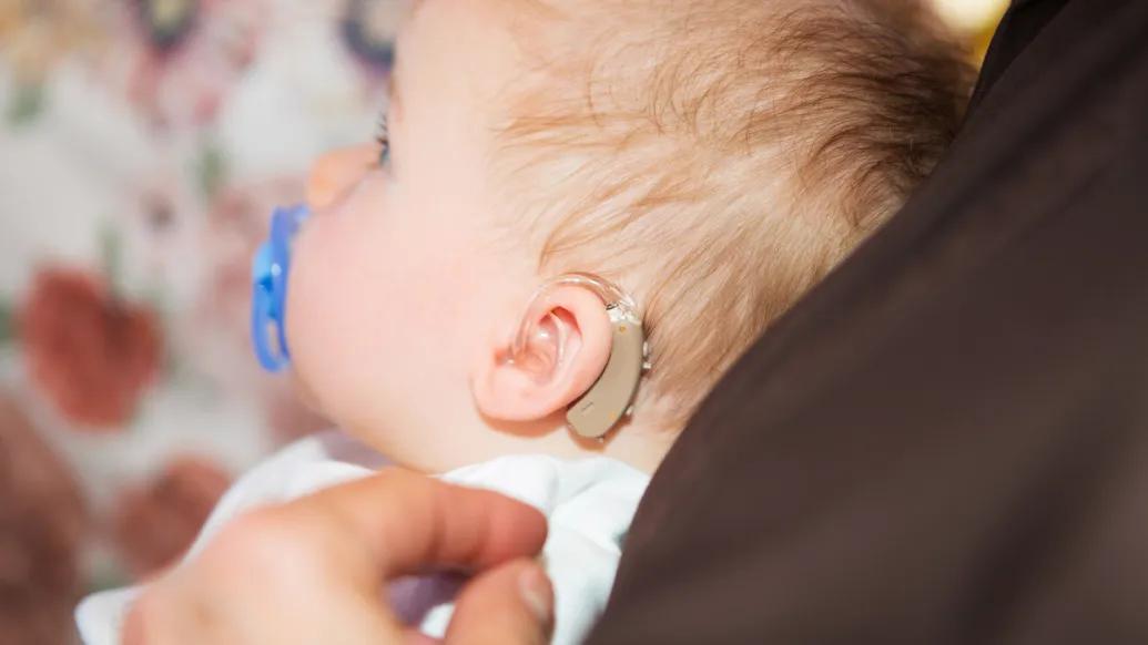 baby with hearing aid on ear looking from side view with blue pacifier in mouth