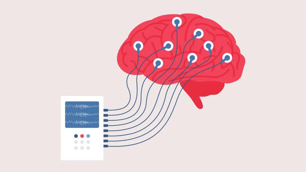 darker pink brain with electrodes from white device