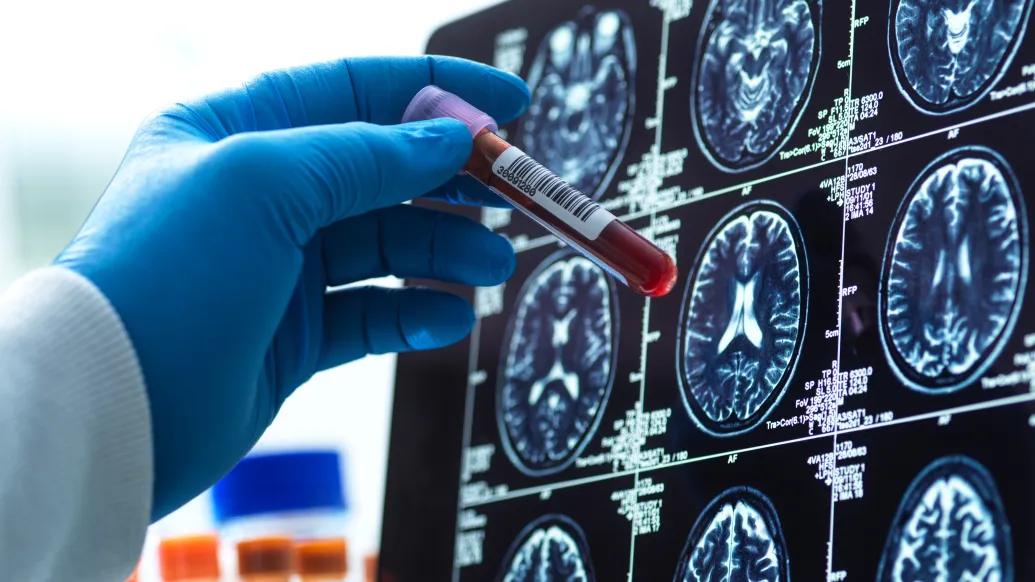 blood sample being checked against the medical scan during a clinical trial