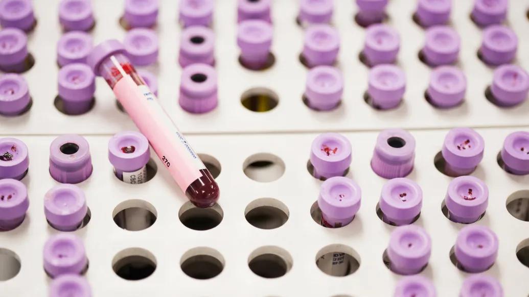 lab tests purple tops