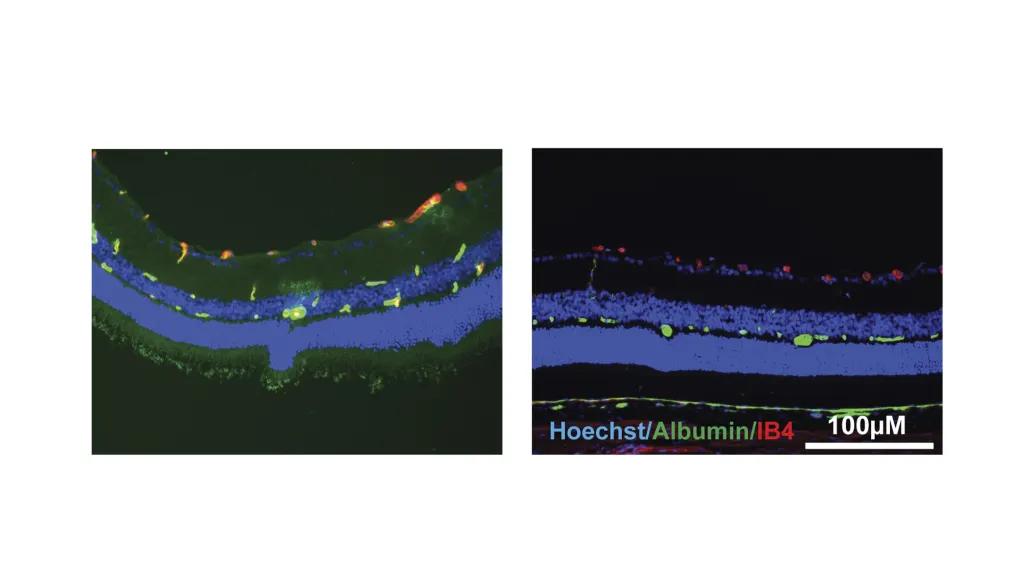 Research image of rat blood vessels before and after norrin treatment 