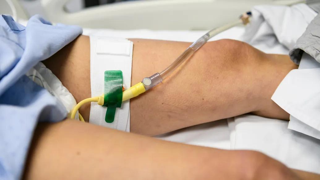 Catheterized hospital patient's leg