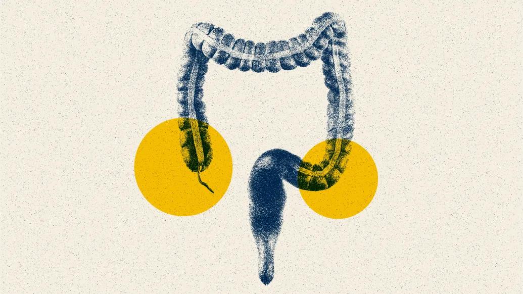 A graphic of a large intestine with two yellow circles