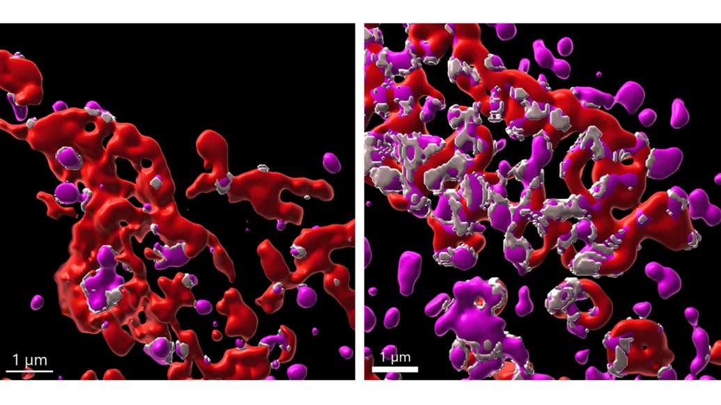Perforin increases endosomal-mitochondrial contact sites in tumor cells. Left is without perforin; right has perforin.