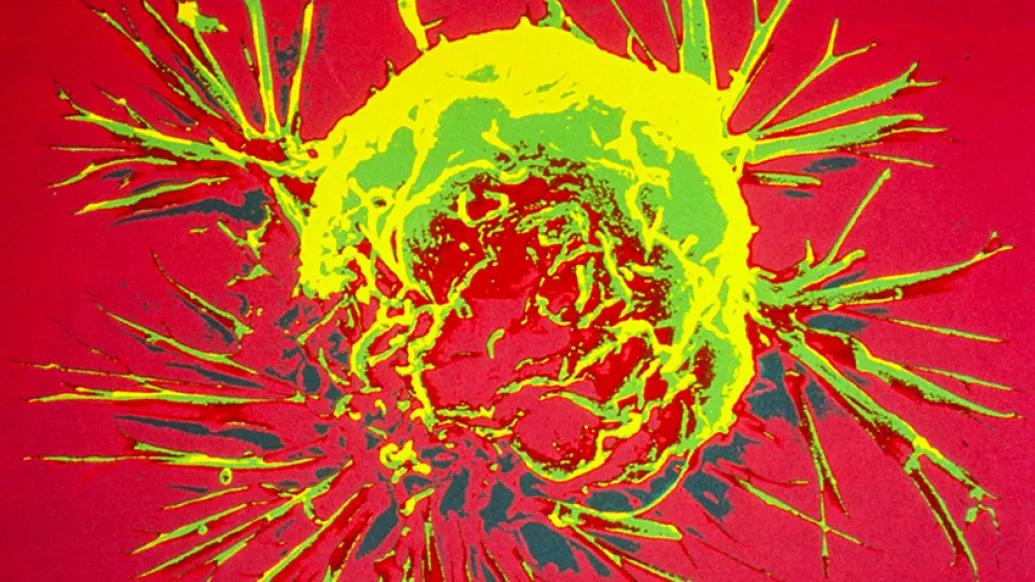 Breast cancer cell