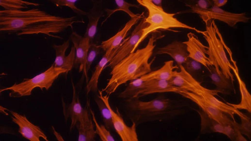 auto immune image