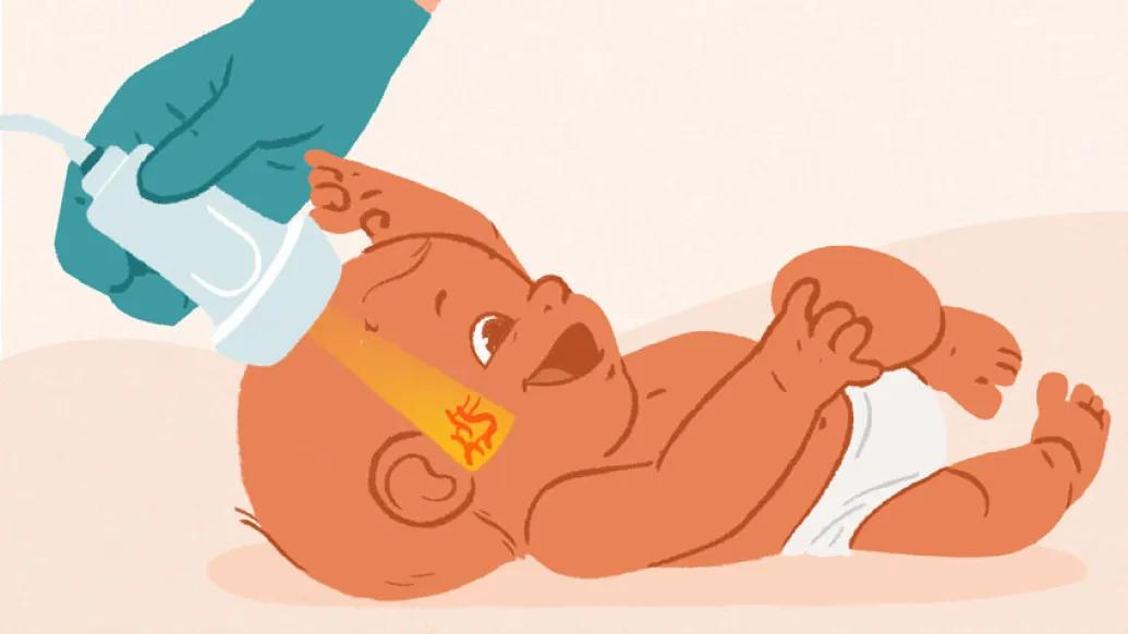 Hand with green gloves holding nsultrasound scanning a baby's head showing red vei 