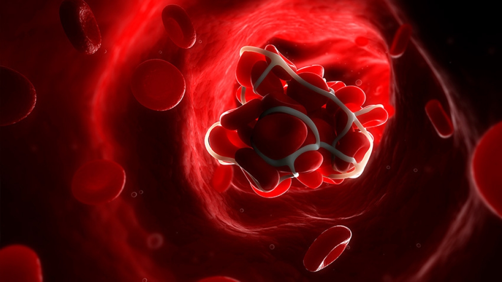 blood clot red cells