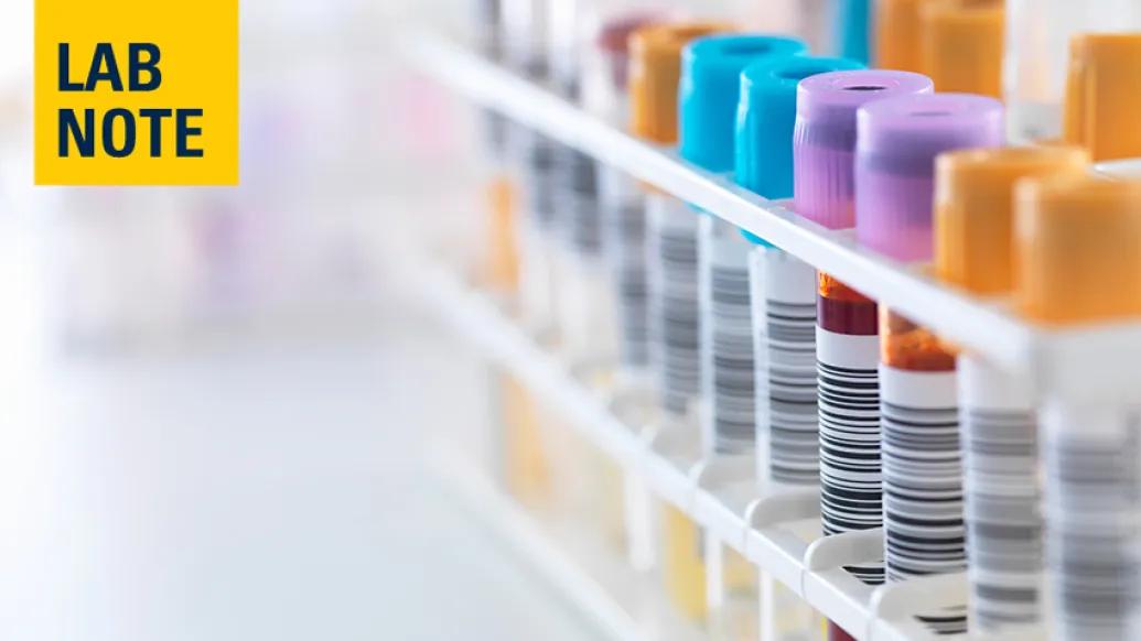 blood vials colorful lab notes