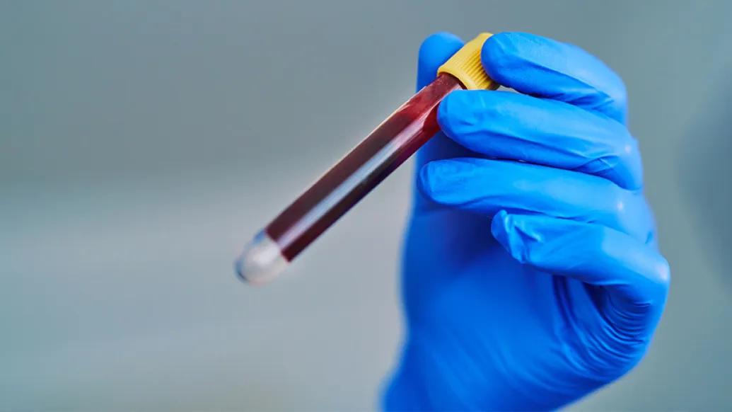 blue glove holding blood vial