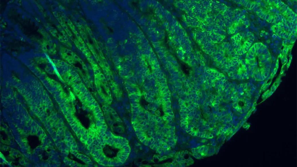 Blue green cell microscopic amino