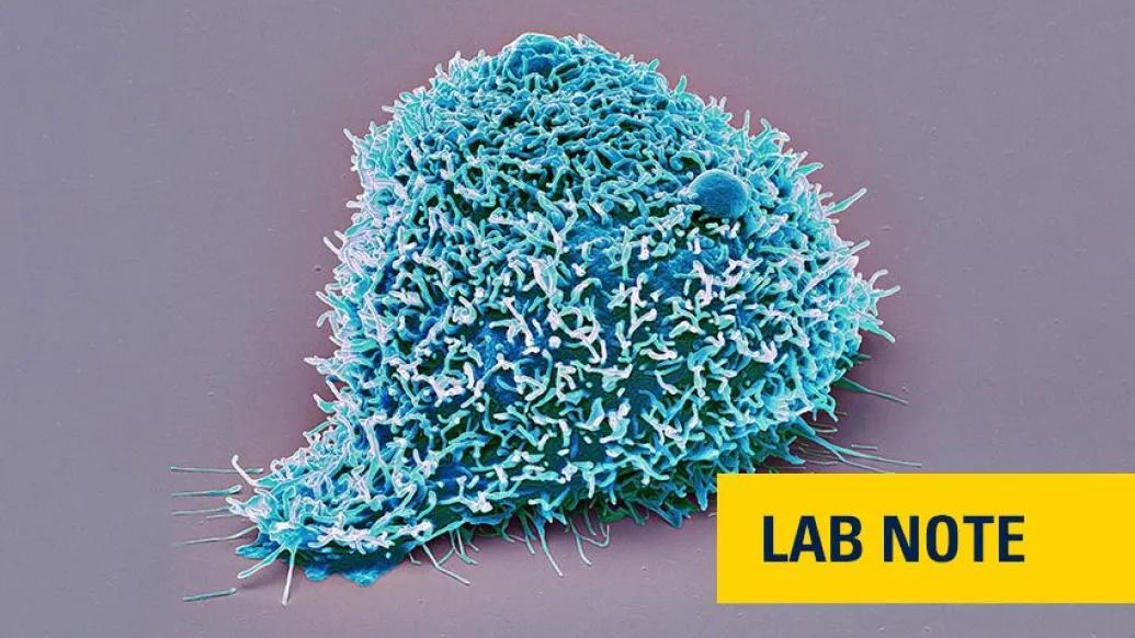blue kidney cancer cell microscopic 